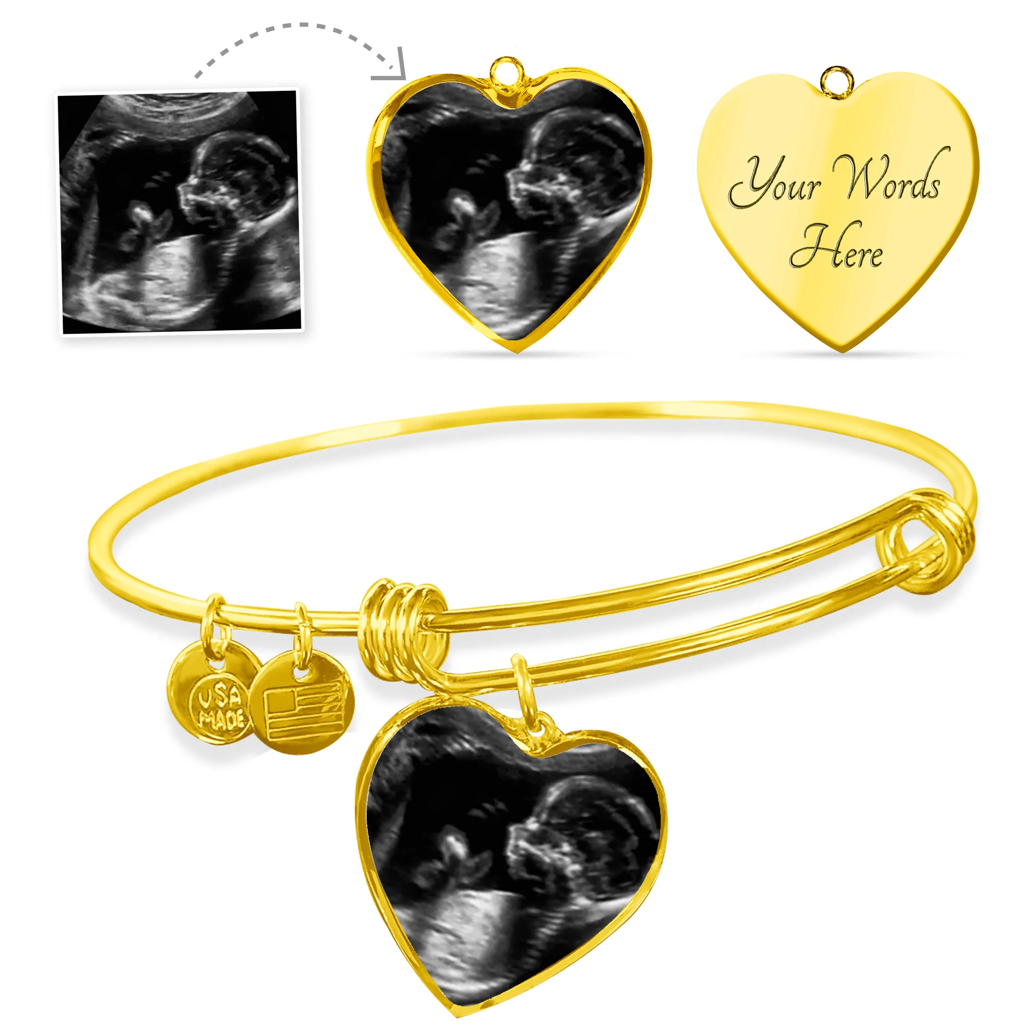 Infant Loss Healing Gift for Grieving Mothers, Keepsake Jewelry Baby Ultrasound Photo Bangle Bracelet